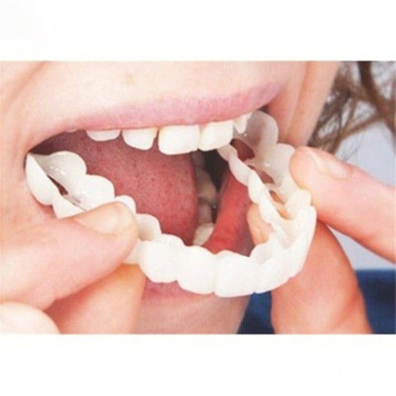 Teeth Whitening With Braces - 1 Nha Khoa Trên Và Giả