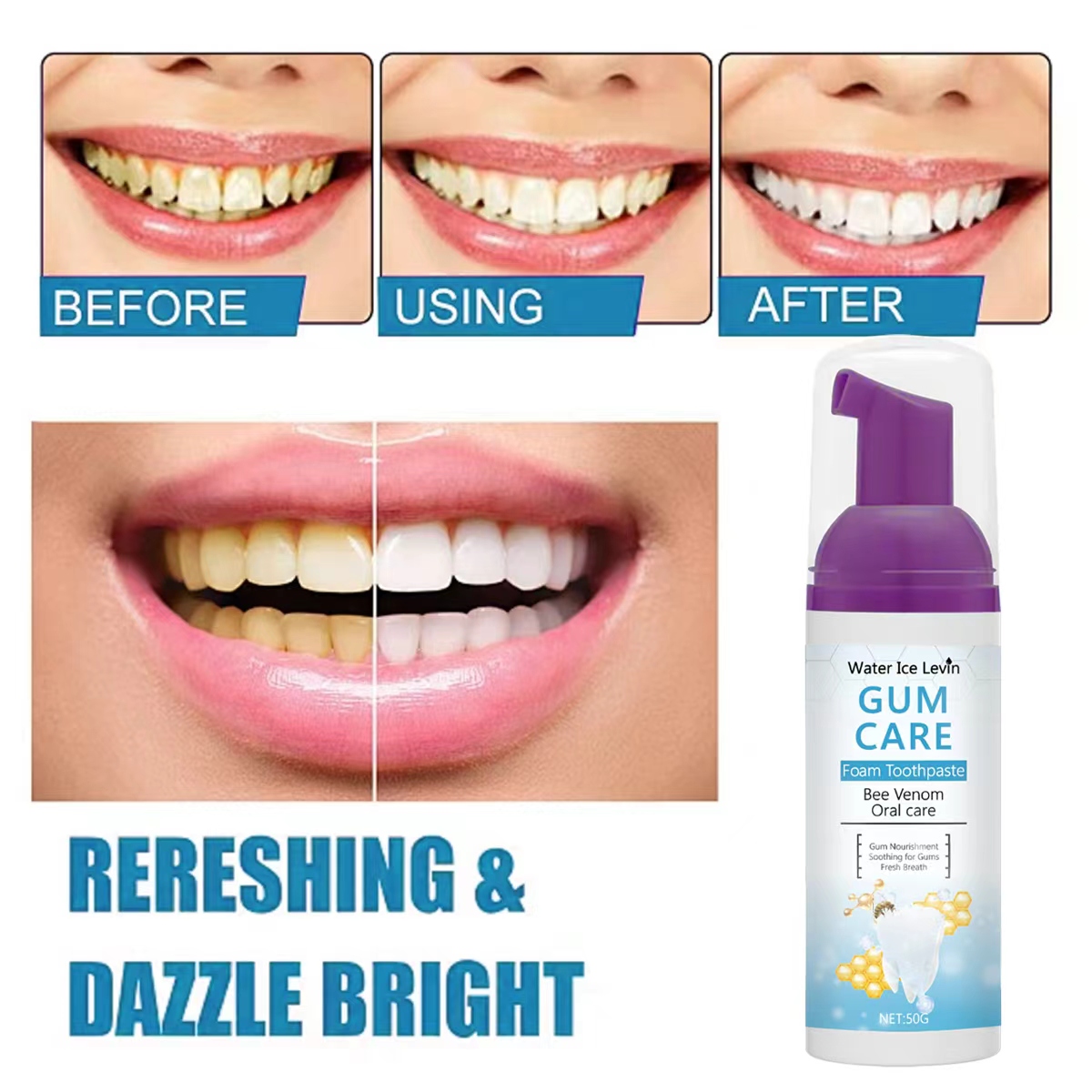 Water Ice Levin Gum Care Foam  - đánh giá và giá Teeth Whitening Xylitol Gum