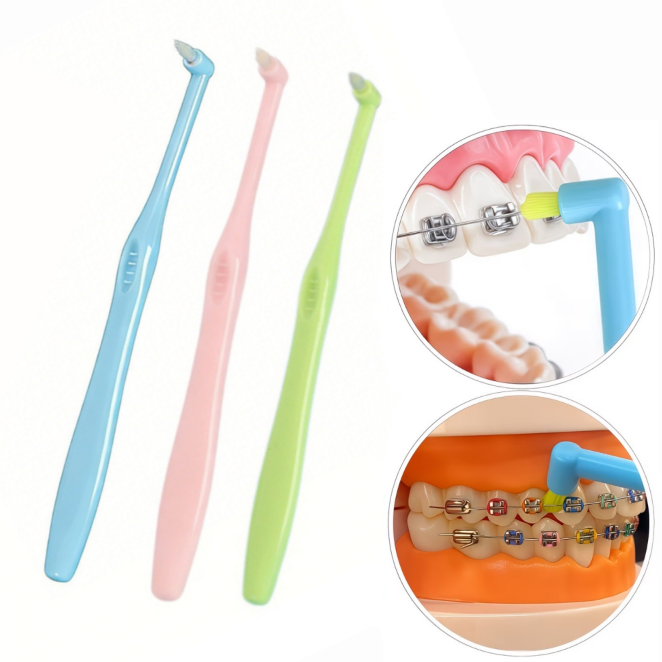 1/3pc Orthodontic Braces Tooth - đánh giá và giá Teeth Whitening With Braces