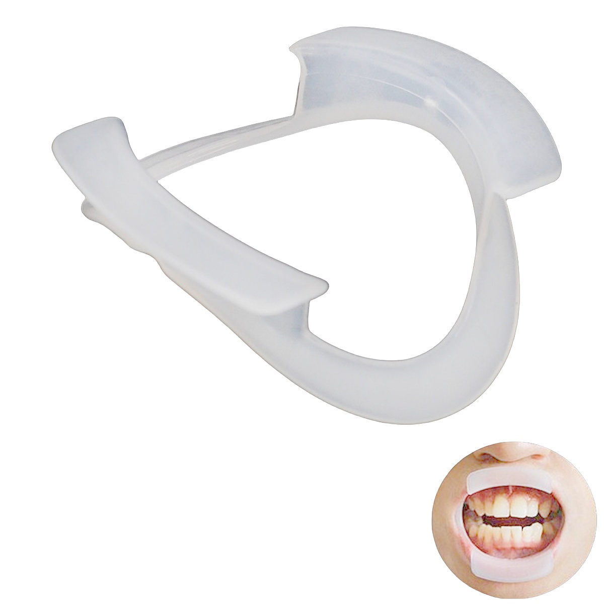 100pcs/bag Dental O-Shape Intr - đánh giá và giá Teeth Whitening With Braces