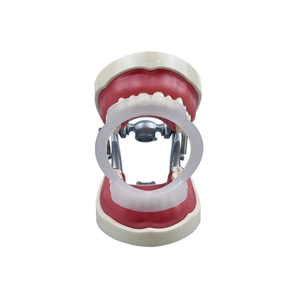 100pcs/bag Dental O-Shape Intr - đánh giá và giá Teeth Whitening With Braces