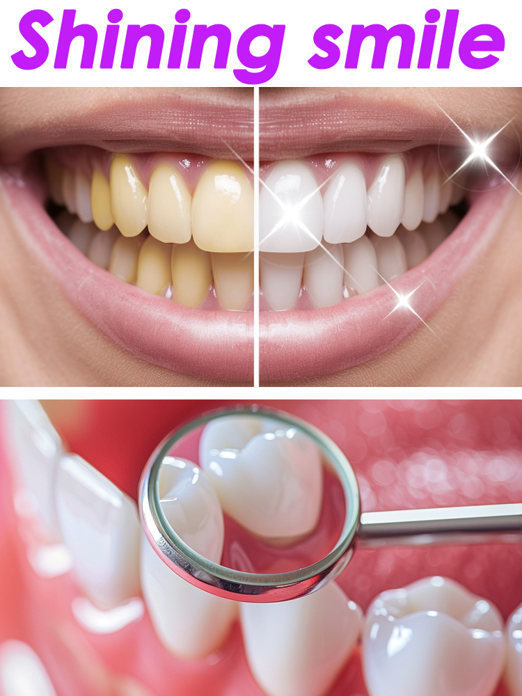 GlorySmile Teeth Whitening Fru - đánh giá và giá Teeth Whitening Xylitol