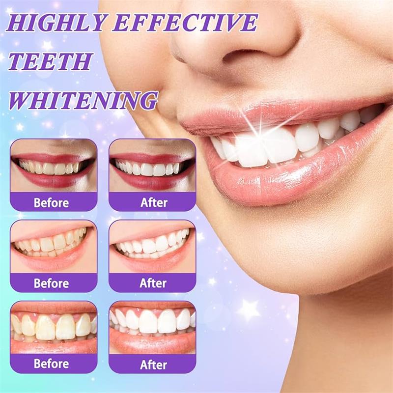 9D Purple Teeth Whitening Toot - đánh giá và giá Teeth Whitening Naturally