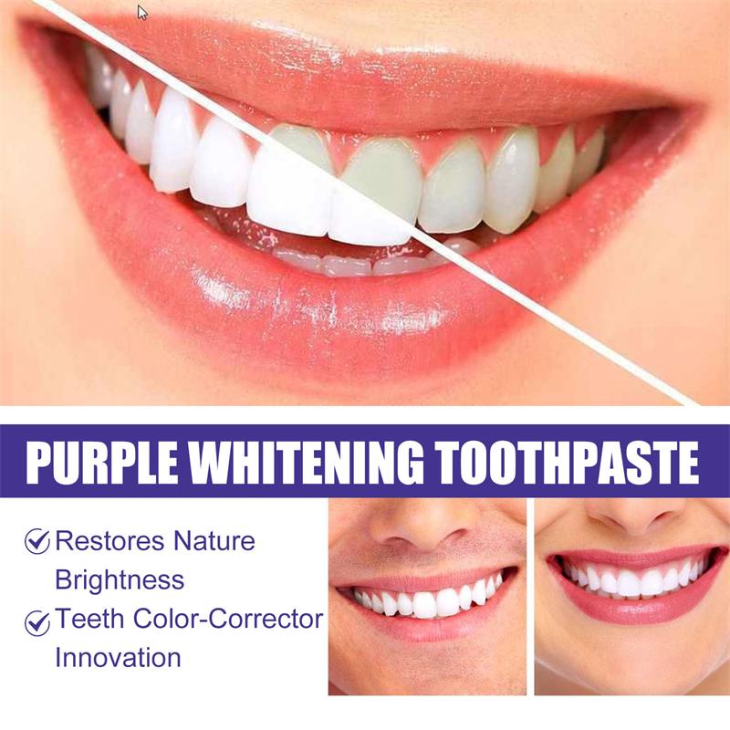 9D Purple Teeth Whitening Toot - đánh giá và giá Teeth Whitening Naturally