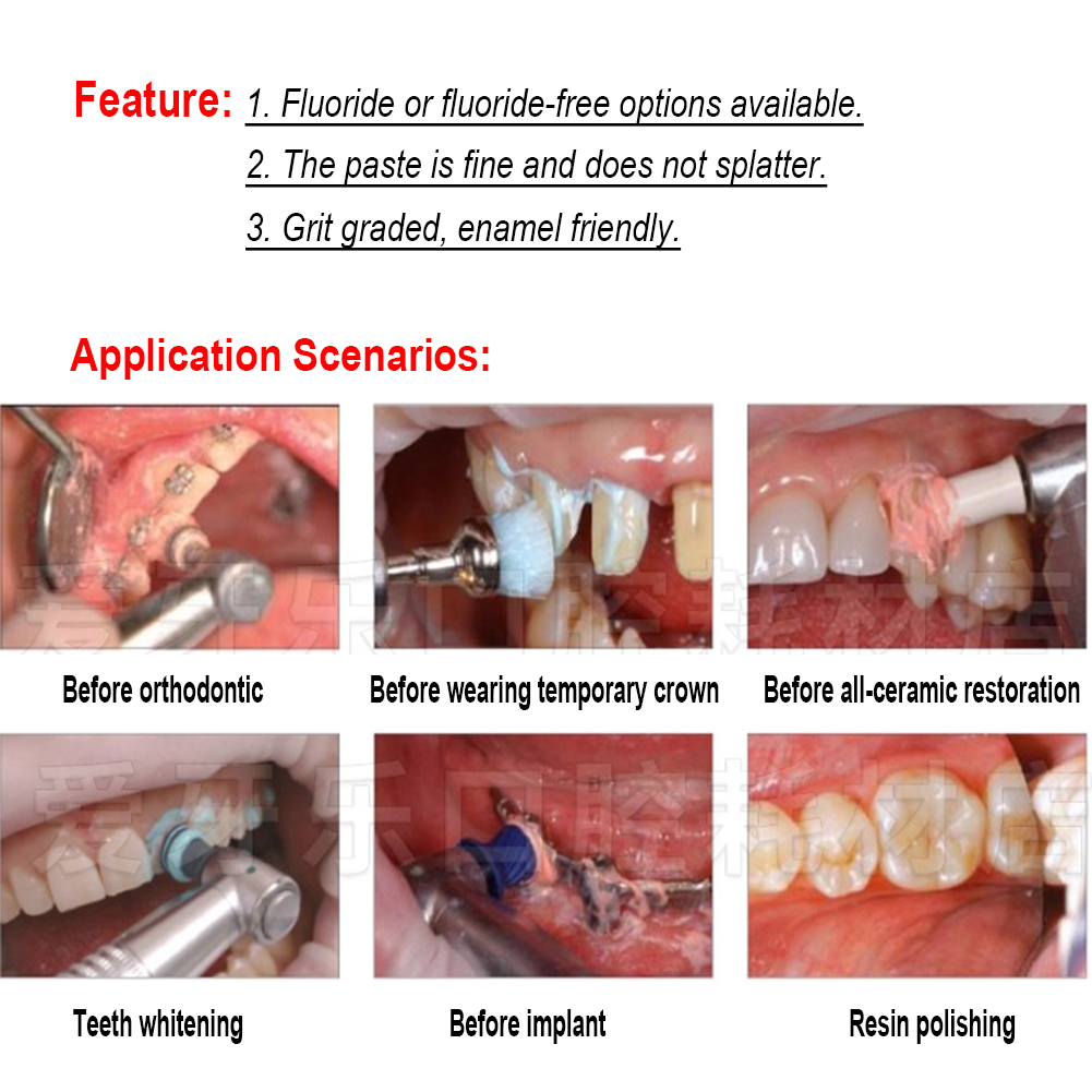 Ivoclar Vivadent Oral Teeth Po - đánh giá và giá Teeth Whitening Xylitol