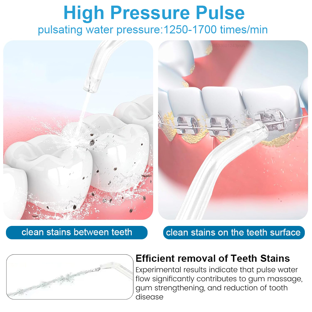 Waterpulse Electric Water Flos - đánh giá và giá Water Flosser Cordless