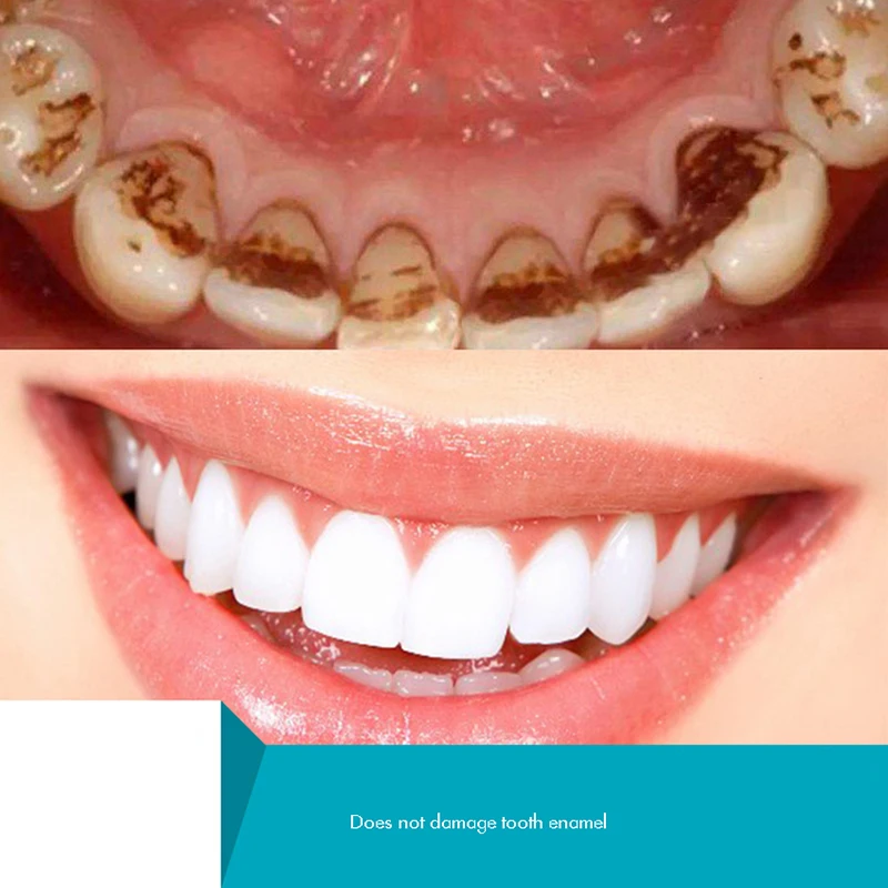 Thảo Dược Răng Bột Làm Trắng R - đánh giá và giá Teeth Whitening Xylitol