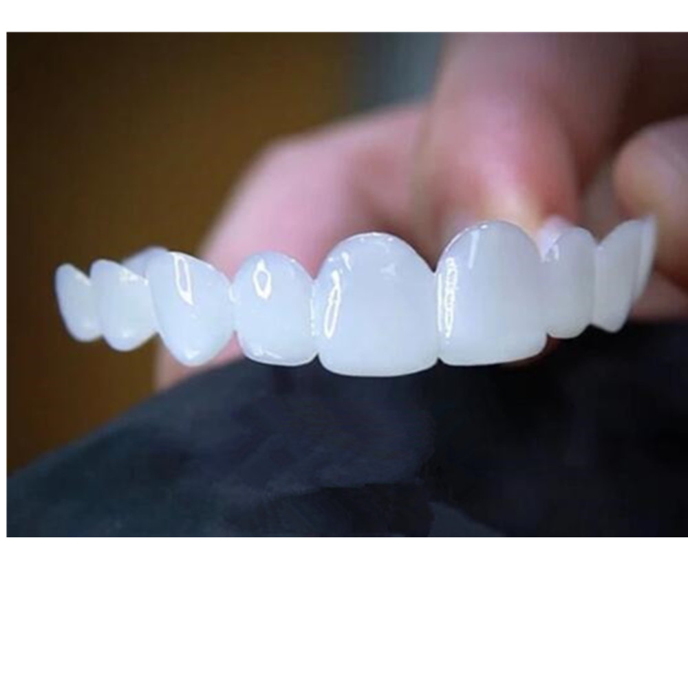 Whitening Teeth Veneers Tempor - đánh giá và giá Teeth Whitening With Braces