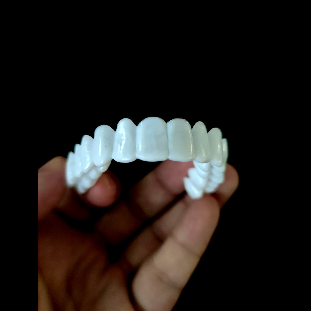 Whitening Teeth Veneers Tempor - đánh giá và giá Teeth Whitening With Braces