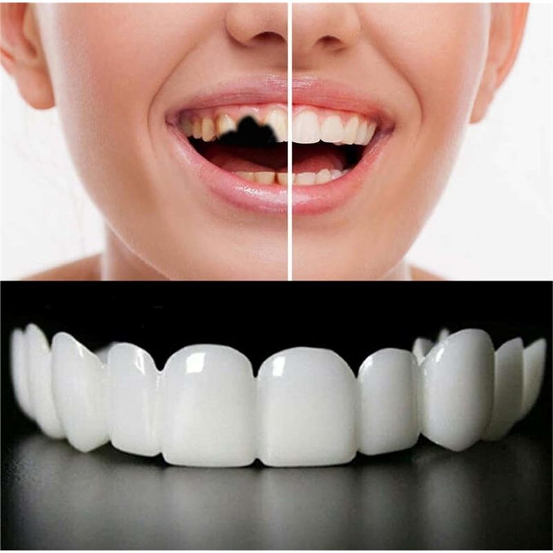 [NEW!ABMK】 2 Pairs,Regain Beau - đánh giá và giá Teeth Whitening With Braces